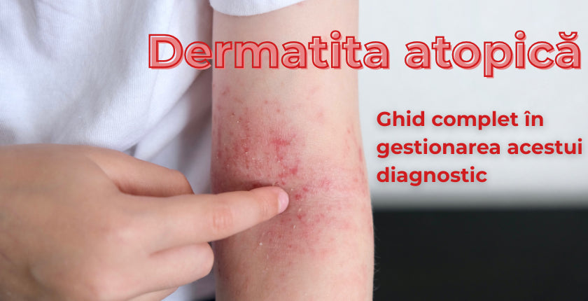 Dermatita atopică: ce rol joacă nutriția în gestionarea acestui diagnostic?