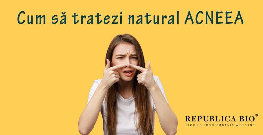 Ai acnee? Află cum o poți trata natural